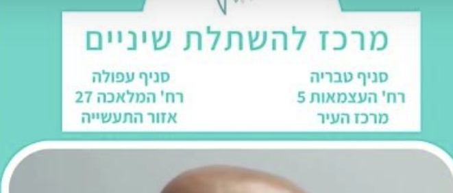 מרפאת שיניים עפולה מרכז להשתלת שיניים